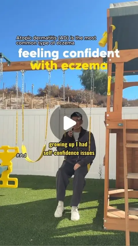 video cover: opening up about atopic dermatitis with the national eczema association